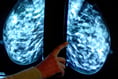 Thousands of Hampshire women miss “vital” breast cancer screenings