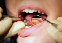 Almost 150 admissions for tooth extractions on children in Hampshire, Southampton and the Isle of Wight