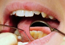 Almost 150 admissions for tooth extractions on children in Hampshire, Southampton and the Isle of Wight