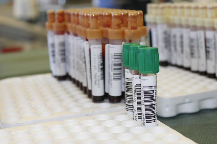 Blood sample stock picture