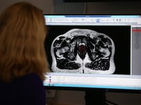 More men diagnosed with prostate cancer in Hampshire and the Isle of Wight